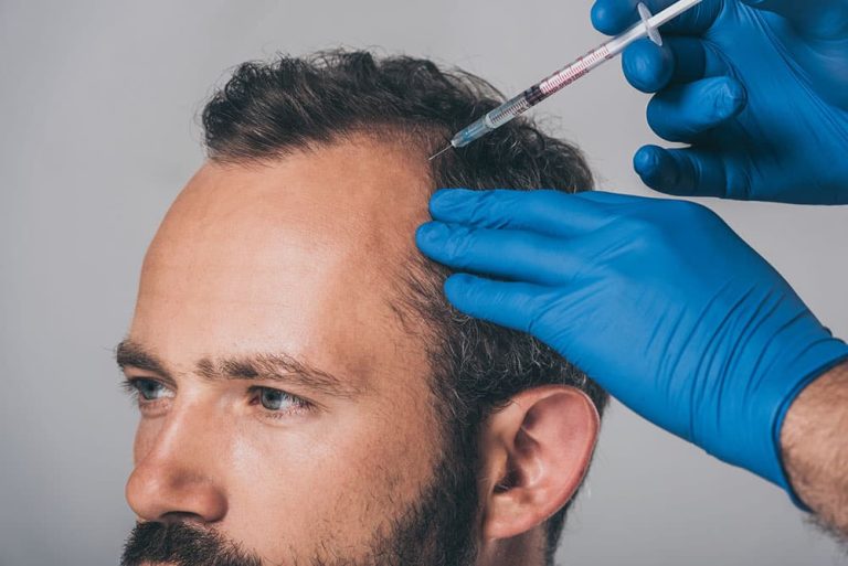 Safe Alopecia Solutions Restoring Confidence And Promoting Long-Term Hair Stability